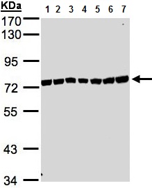 Western blot - Anti-KIAA1530 antibody - N-terminal (AB137644), expandable thumbnail