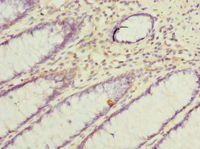 Immunohistochemistry (Formalin/PFA-fixed paraffin-embedded sections) - Anti-KIAA1576 antibody (AB235311)