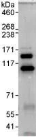 Immunoprecipitation - Anti-KIAA1688 antibody (AB93780)