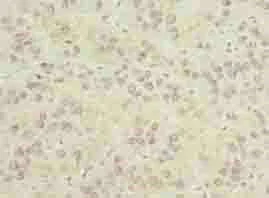 Immunohistochemistry (Formalin/PFA-fixed paraffin-embedded sections) - Anti-KIAA1737/CIPC antibody (AB235359)