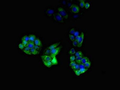 Immunocytochemistry/ Immunofluorescence - Anti-KIAA1881 antibody (AB234752), expandable thumbnail
