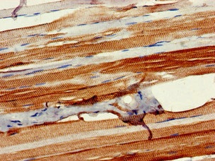 Immunohistochemistry (Formalin/PFA-fixed paraffin-embedded sections) - Anti-KIAA1881 antibody (AB234752), expandable thumbnail