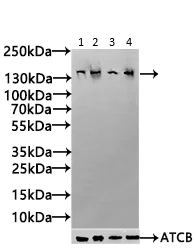 Western blot - Anti-KIAA1881 antibody (AB234752)
