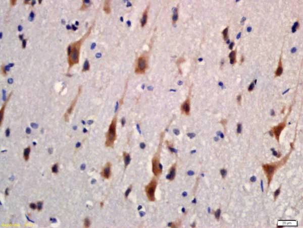 Immunohistochemistry (Formalin/PFA-fixed paraffin-embedded sections) - Anti-KIBRA antibody (AB216508)