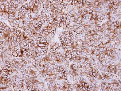 Immunohistochemistry (Formalin/PFA-fixed paraffin-embedded sections) - Anti-Kidins220 antibody (AB97345)