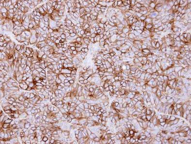Immunohistochemistry (Formalin/PFA-fixed paraffin-embedded sections) - Anti-Kidins220 antibody (AB97345)
