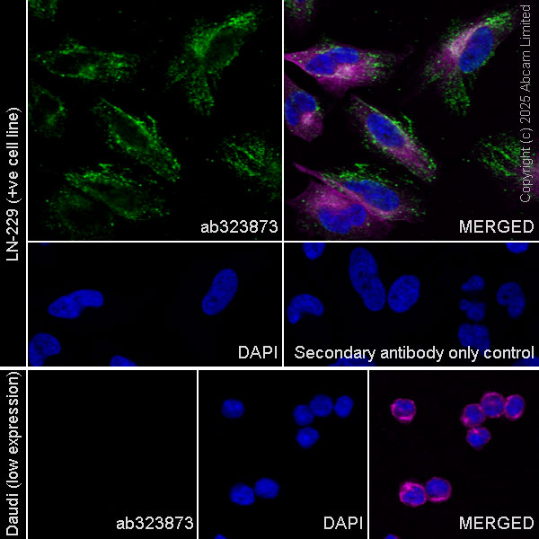 Immunocytochemistry/ Immunofluorescence - Anti-KIF13A antibody [EPR29130-81] (AB323873), expandable thumbnail