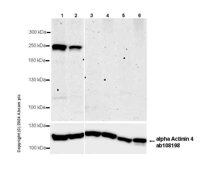 Western blot - Anti-KIF13A antibody [EPR29130-81] (AB323873)