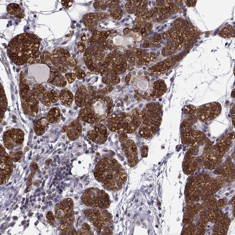 Immunohistochemistry (Formalin/PFA-fixed paraffin-embedded sections) - Anti-KIF13B antibody (AB272595)