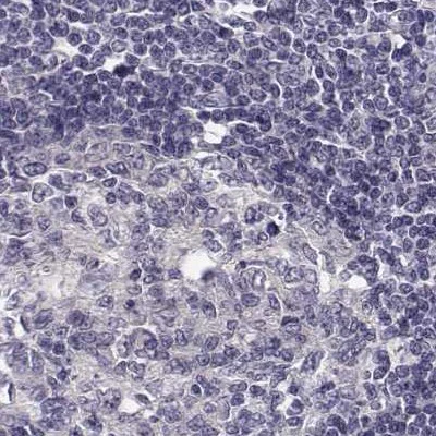 Immunohistochemistry (Formalin/PFA-fixed paraffin-embedded sections) - Anti-KIF13B antibody (AB272595)