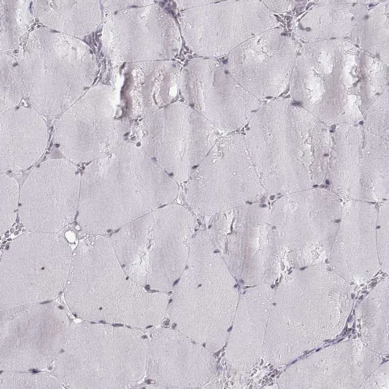Immunohistochemistry (Formalin/PFA-fixed paraffin-embedded sections) - Anti-KIF13B antibody (AB272595)