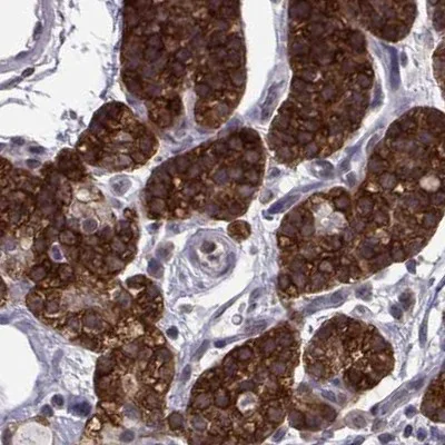Immunohistochemistry (Formalin/PFA-fixed paraffin-embedded sections) - Anti-KIF13B antibody (AB272595)