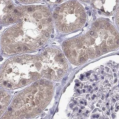 Immunohistochemistry (Formalin/PFA-fixed paraffin-embedded sections) - Anti-KIF13B antibody (AB272595)