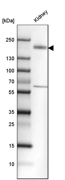 Western blot - Anti-KIF13B antibody (AB272595)