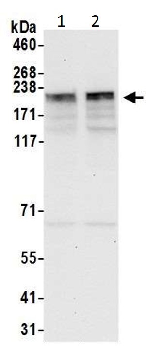 Western blot - Anti-KIF14 antibody (AB3747)