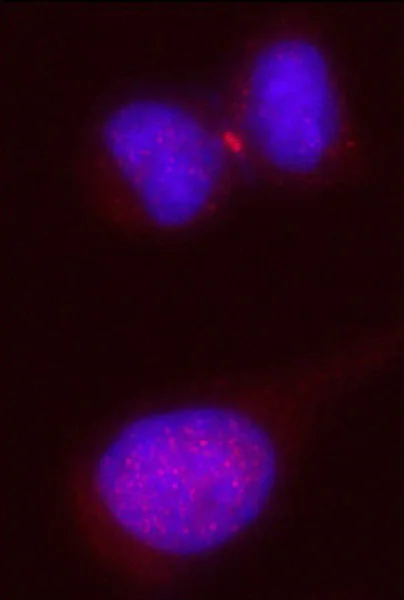 Immunocytochemistry/ Immunofluorescence - Anti-KIF14 antibody (AB71155)