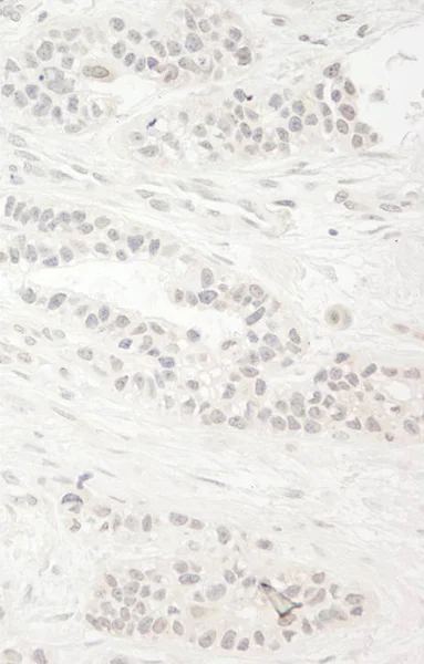 Immunohistochemistry (Formalin/PFA-fixed paraffin-embedded sections) - Anti-KIF14 antibody (AB71155)