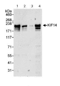 Western blot - Anti-KIF14 antibody (AB71155)