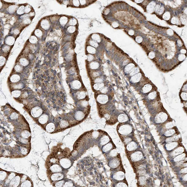 Immunohistochemistry (Formalin/PFA-fixed paraffin-embedded sections) - Anti-KIF15 antibody (AB272615)