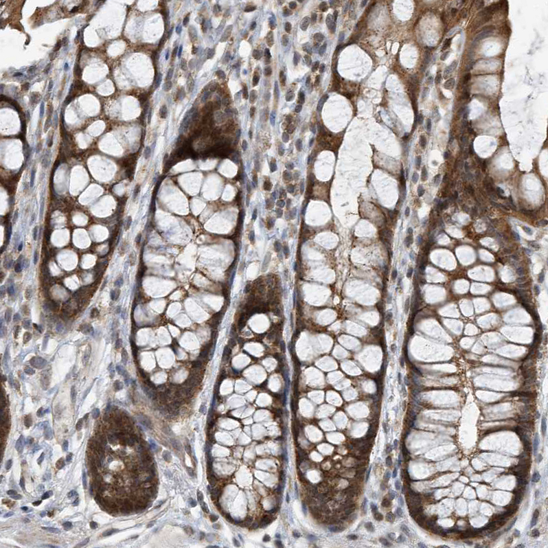 Immunohistochemistry (Formalin/PFA-fixed paraffin-embedded sections) - Anti-KIF15 antibody (AB272615), expandable thumbnail