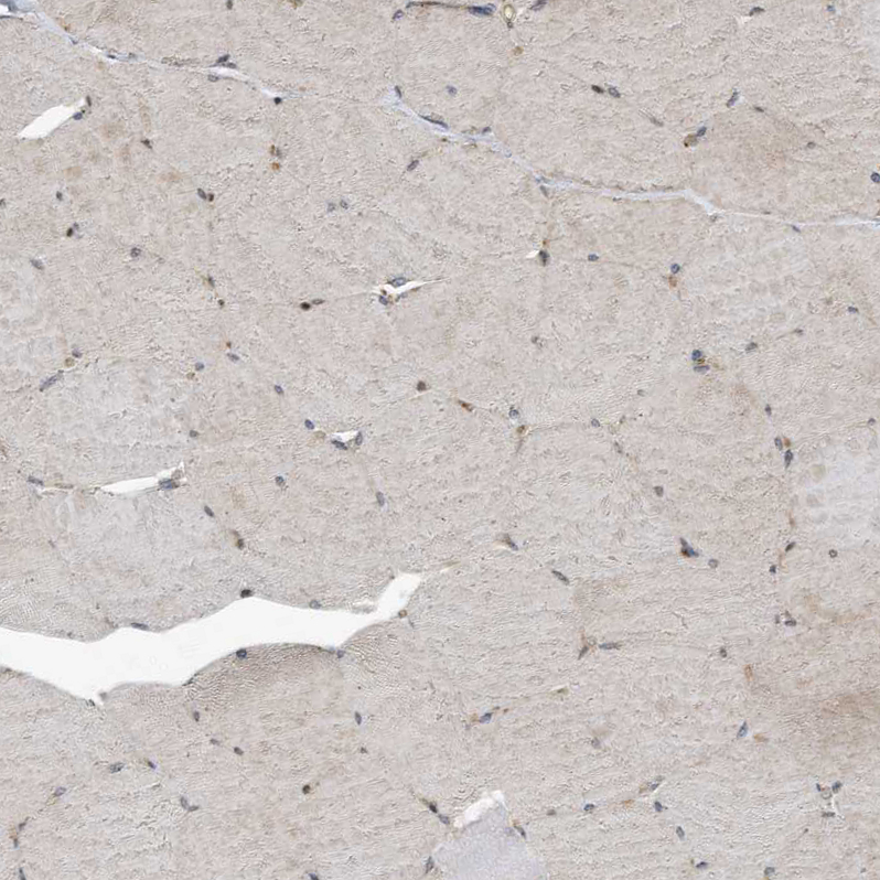 Immunohistochemistry (Formalin/PFA-fixed paraffin-embedded sections) - Anti-KIF15 antibody (AB272615), expandable thumbnail