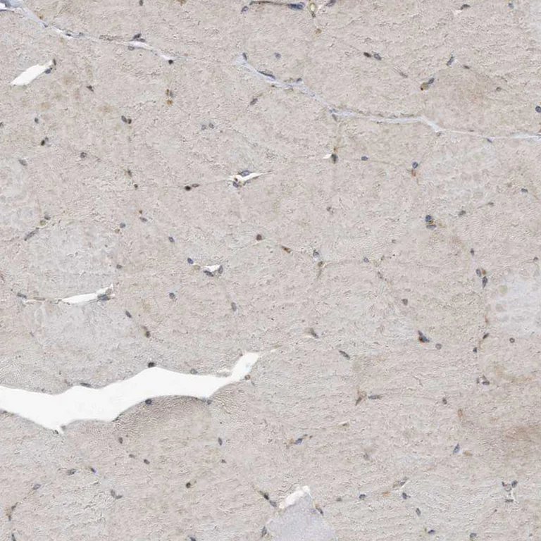 Immunohistochemistry (Formalin/PFA-fixed paraffin-embedded sections) - Anti-KIF15 antibody (AB272615)