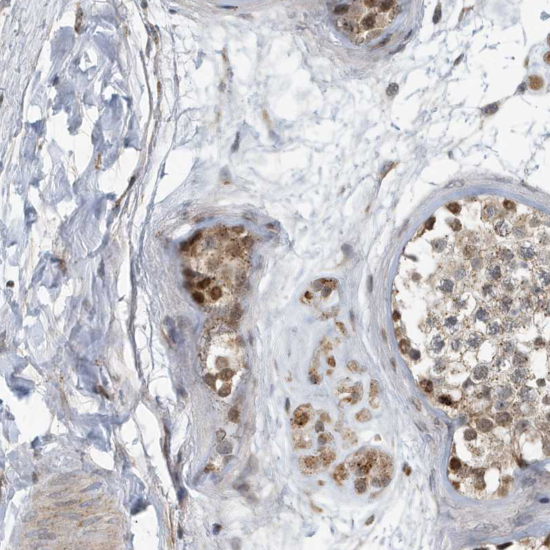 Immunohistochemistry (Formalin/PFA-fixed paraffin-embedded sections) - Anti-KIF15 antibody (AB272615), expandable thumbnail