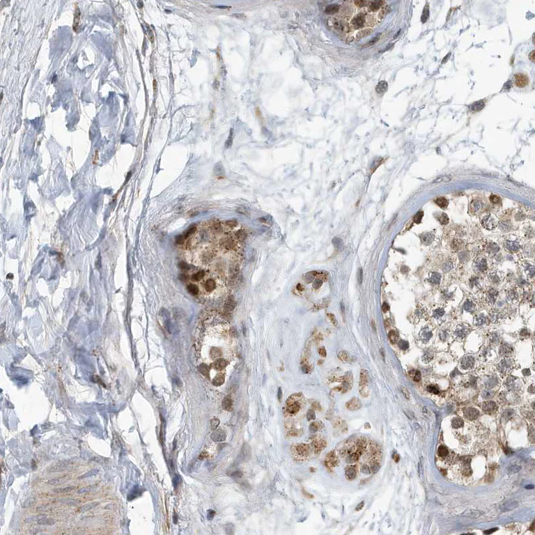Immunohistochemistry (Formalin/PFA-fixed paraffin-embedded sections) - Anti-KIF15 antibody (AB272615)