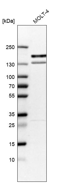 Western blot - Anti-KIF15 antibody (AB272615), expandable thumbnail