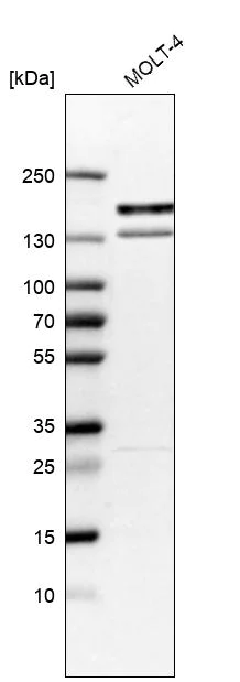 Western blot - Anti-KIF15 antibody (AB272615)