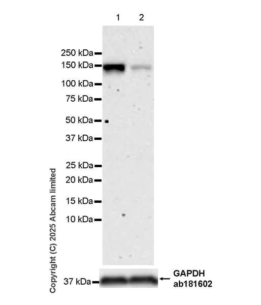 Western blot - Anti-KIF15 antibody [EPR30397-528] (AB324871)