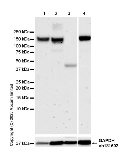 Western blot - Anti-KIF15 antibody [EPR30397-528] (AB324871)