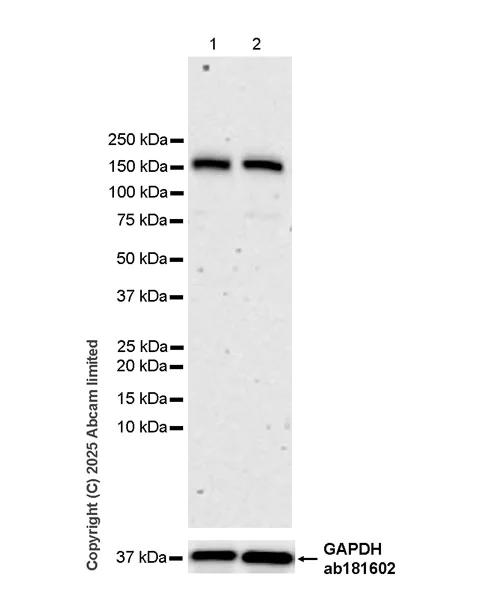 Western blot - Anti-KIF15 antibody [EPR30397-528] (AB324871)
