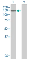 Western blot - Anti-KIF16B antibody (AB67790)