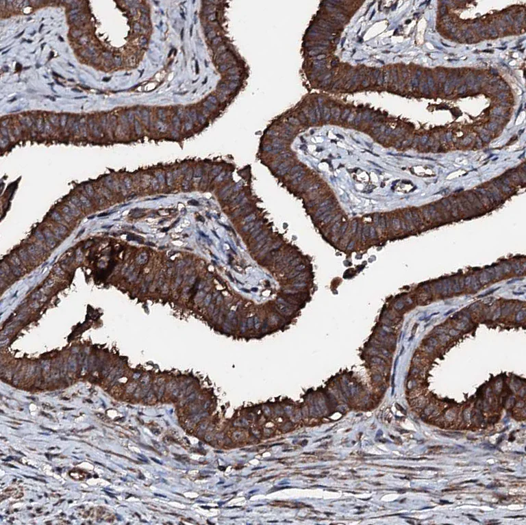 Immunohistochemistry (Formalin/PFA-fixed paraffin-embedded sections) - Anti-KIF18A antibody (AB251863)