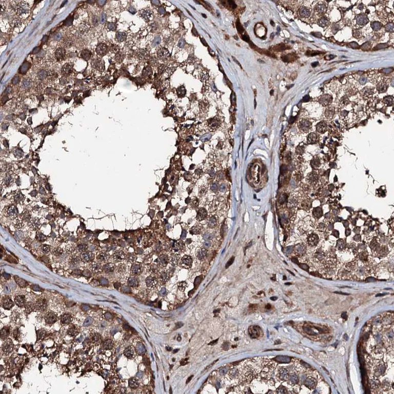Immunohistochemistry (Formalin/PFA-fixed paraffin-embedded sections) - Anti-KIF18A antibody (AB251863)