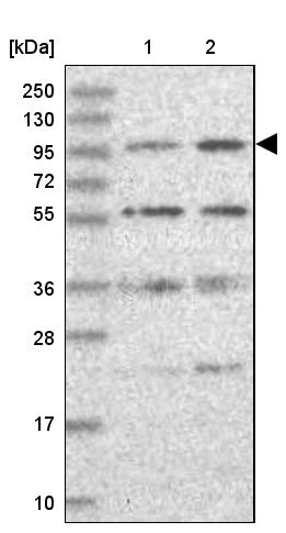 Western blot - Anti-KIF18A antibody (AB251863)