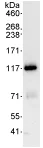 Immunoprecipitation - Anti-KIF18A antibody (AB72417)