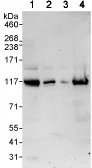 Western blot - Anti-KIF18A antibody (AB72417)