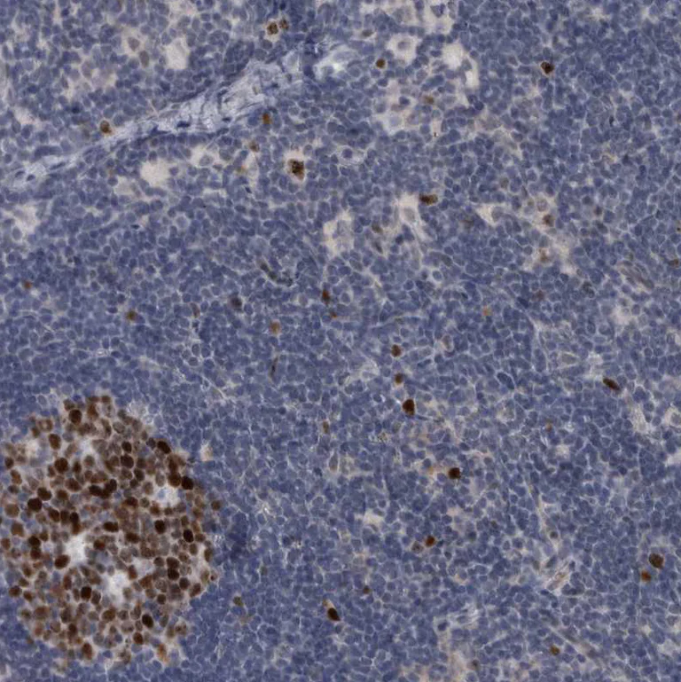 Immunohistochemistry (Formalin/PFA-fixed paraffin-embedded sections) - Anti-KIF18B antibody (AB121798)