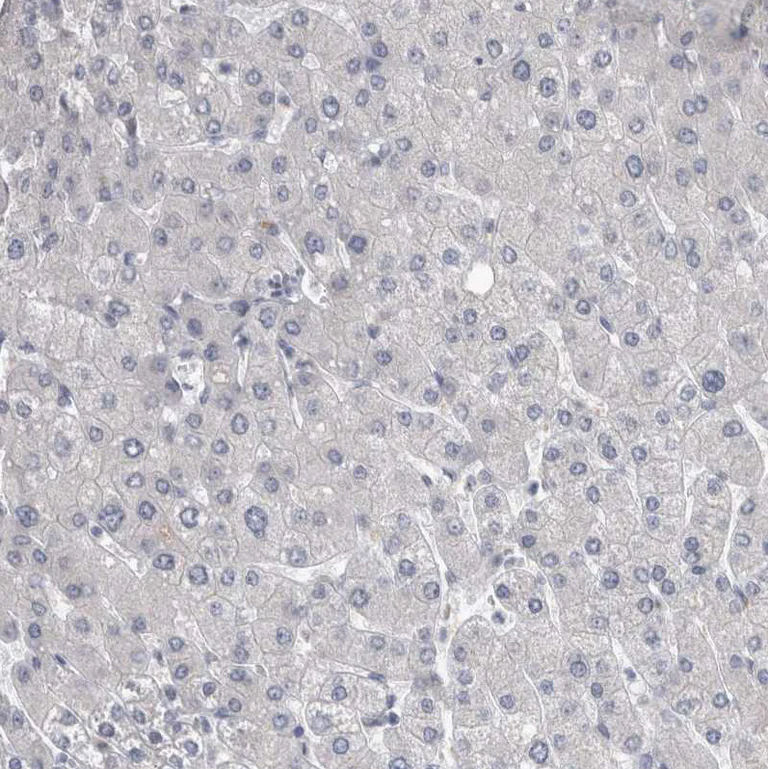 Immunohistochemistry (Formalin/PFA-fixed paraffin-embedded sections) - Anti-KIF18B antibody (AB121798)