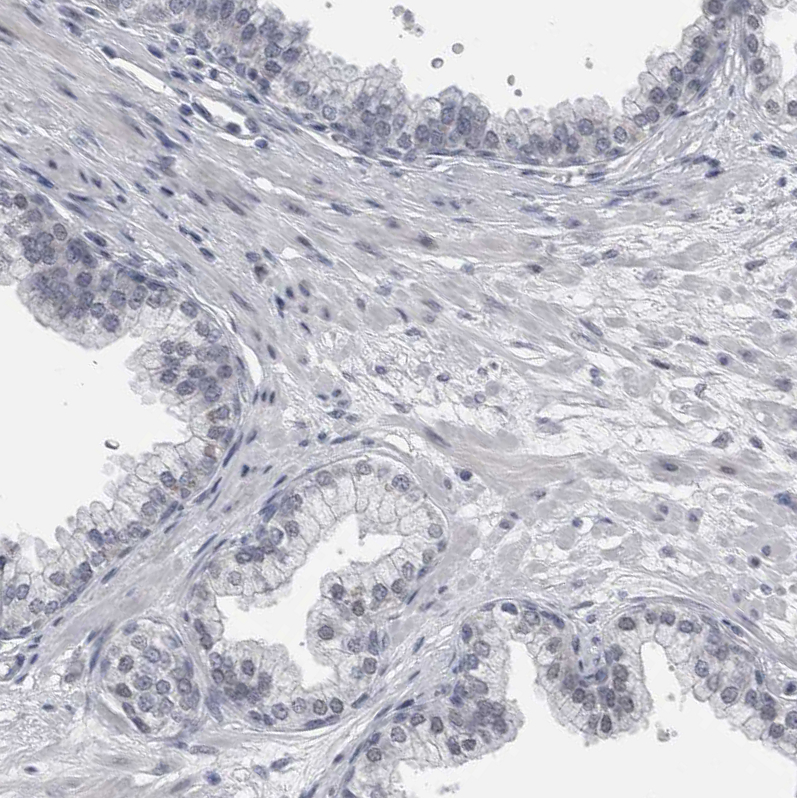 Immunohistochemistry (Formalin/PFA-fixed paraffin-embedded sections) - Anti-KIF18B antibody (AB121798)