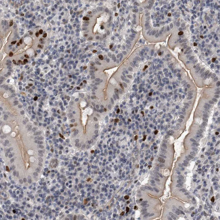 Immunohistochemistry (Formalin/PFA-fixed paraffin-embedded sections) - Anti-KIF18B antibody (AB121798)
