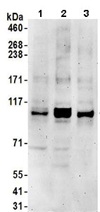 Western blot - Anti-KIF18B antibody (AB168812)