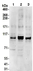 Western blot - Anti-KIF18B antibody (AB168812)