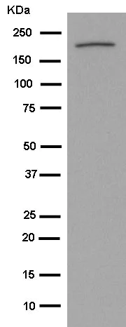 Western blot - Anti-KIF1A antibody [EPR11790(B)] (AB180153)