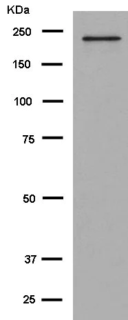 Western blot - Anti-KIF1A antibody [EPR11790(B)] (AB180153)