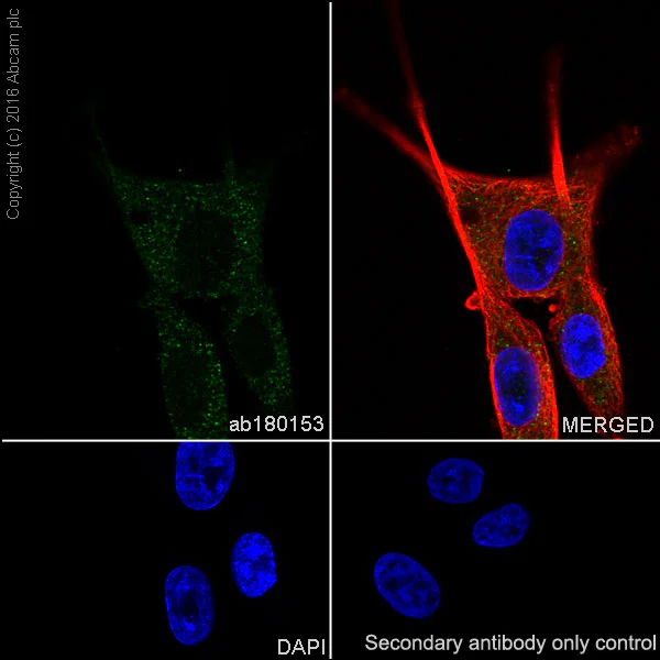 Immunocytochemistry/ Immunofluorescence - Anti-KIF1A antibody [EPR11790(B)] - BSA and Azide free (AB240222)