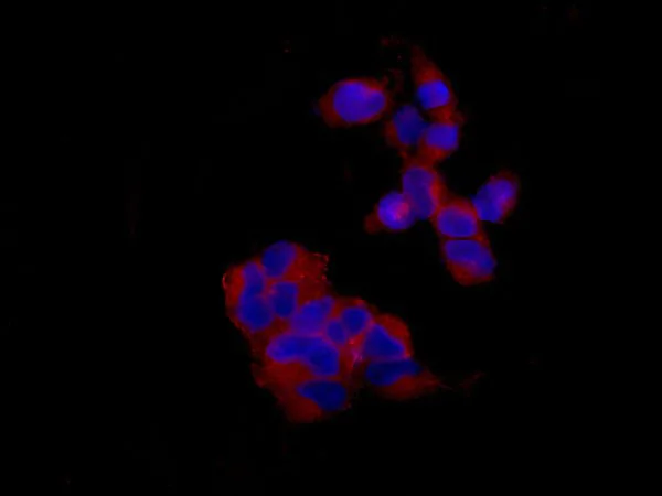 Immunocytochemistry/ Immunofluorescence - Anti-KIF1A antibody [EPR11790(B)] - BSA and Azide free (AB240222)