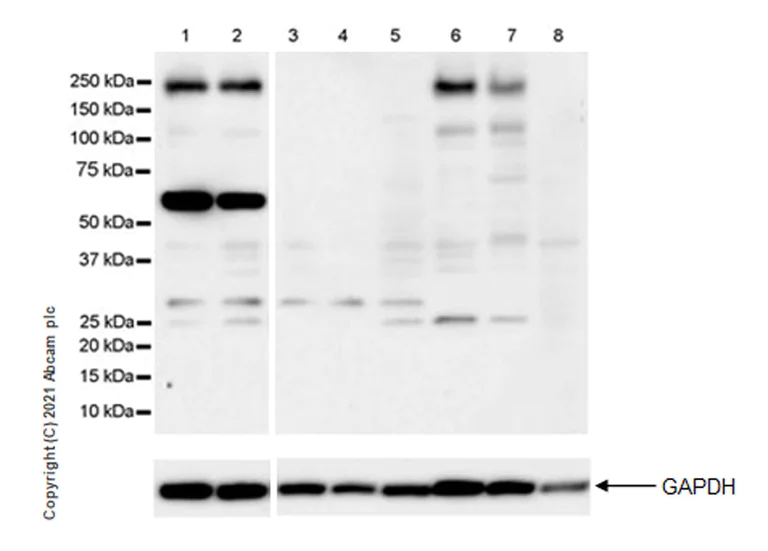 Western blot - Anti-KIF1A antibody [EPR24329-6] - BSA and Azide free (AB282820)